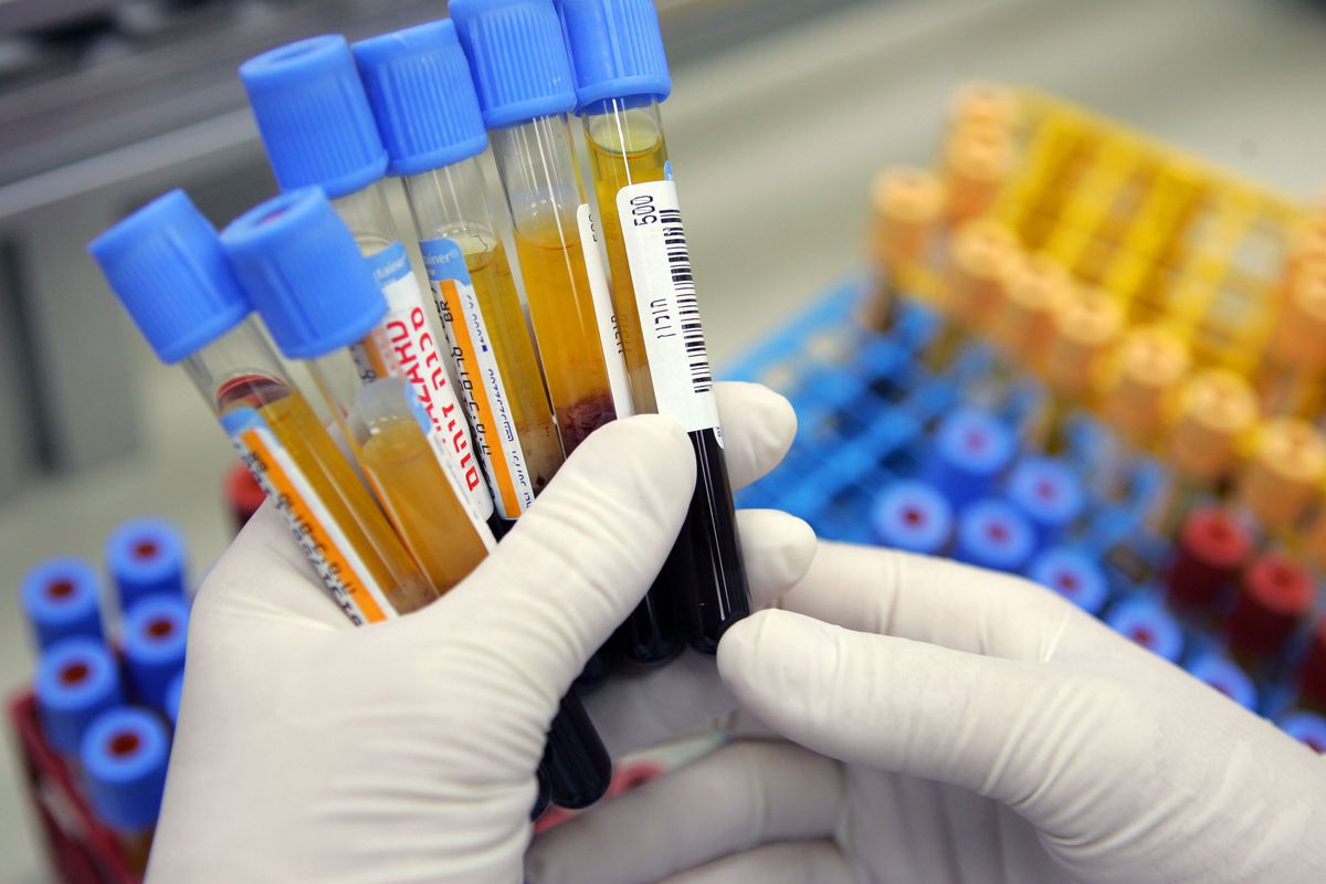 欧洲新冠病毒早在武汉疫情前已传播，或源于美国德特里克堡